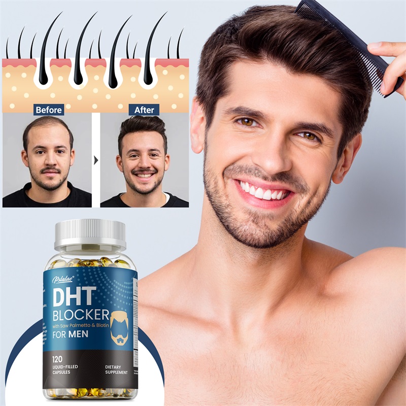 DHT Blockers for Men - Contain – Biotin Hair Growth recenzja i cena