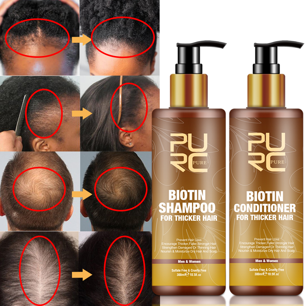 PURC Smoothing Hair Scalp Trea – Biotin Hair Growth recenzja i cena