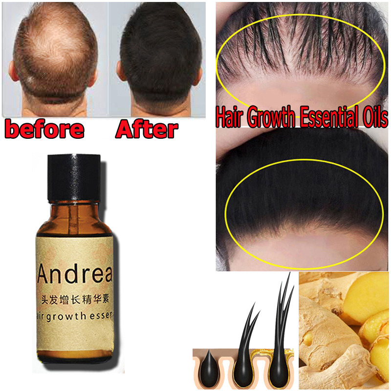 2/5/10Pcs Andrea Hair Growth S – Biotin Hair Growth recenzja i cena